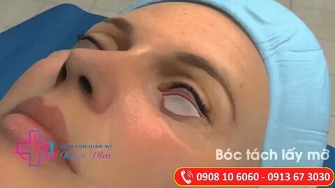 Операция на глаза владивосток