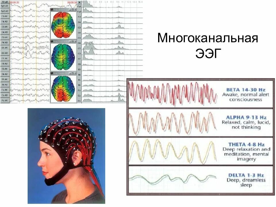 Чем отличается ээг от