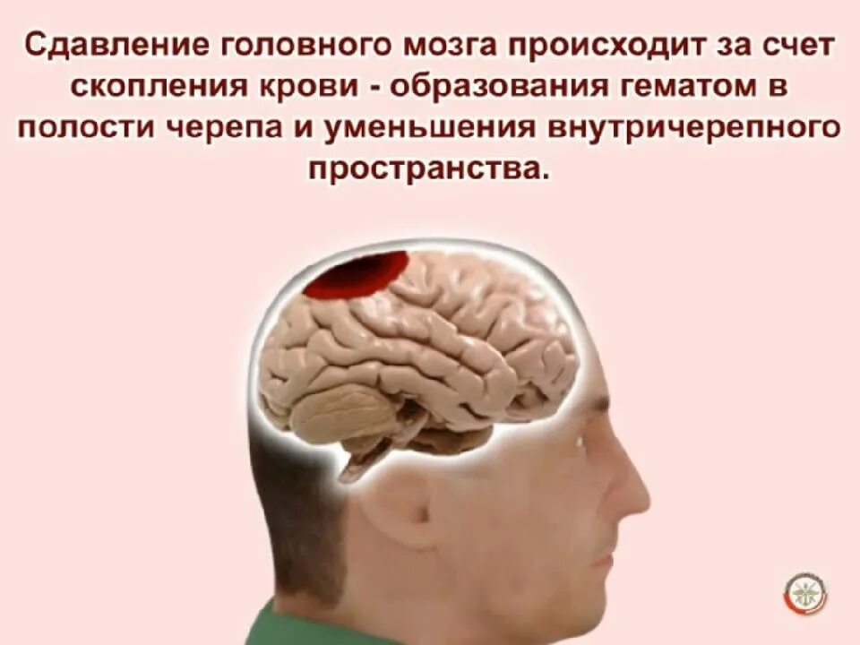 Черепно мозговую травму головы. Черепно-мозговая травма сотрясение головного мозга. травмы головноготмозга. сотрясение сдавление головного мозга. повреждения черепа и головного мозга.