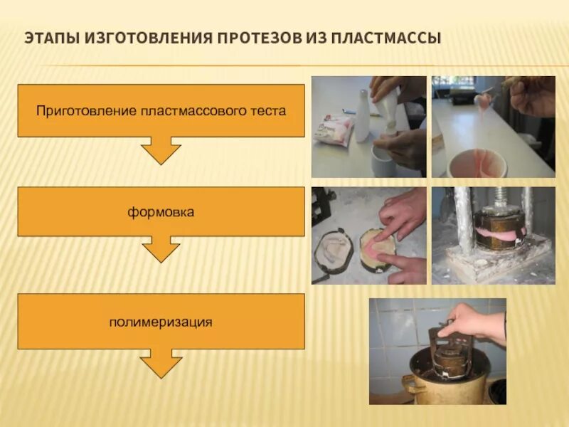 Полимеризация съемных протезов