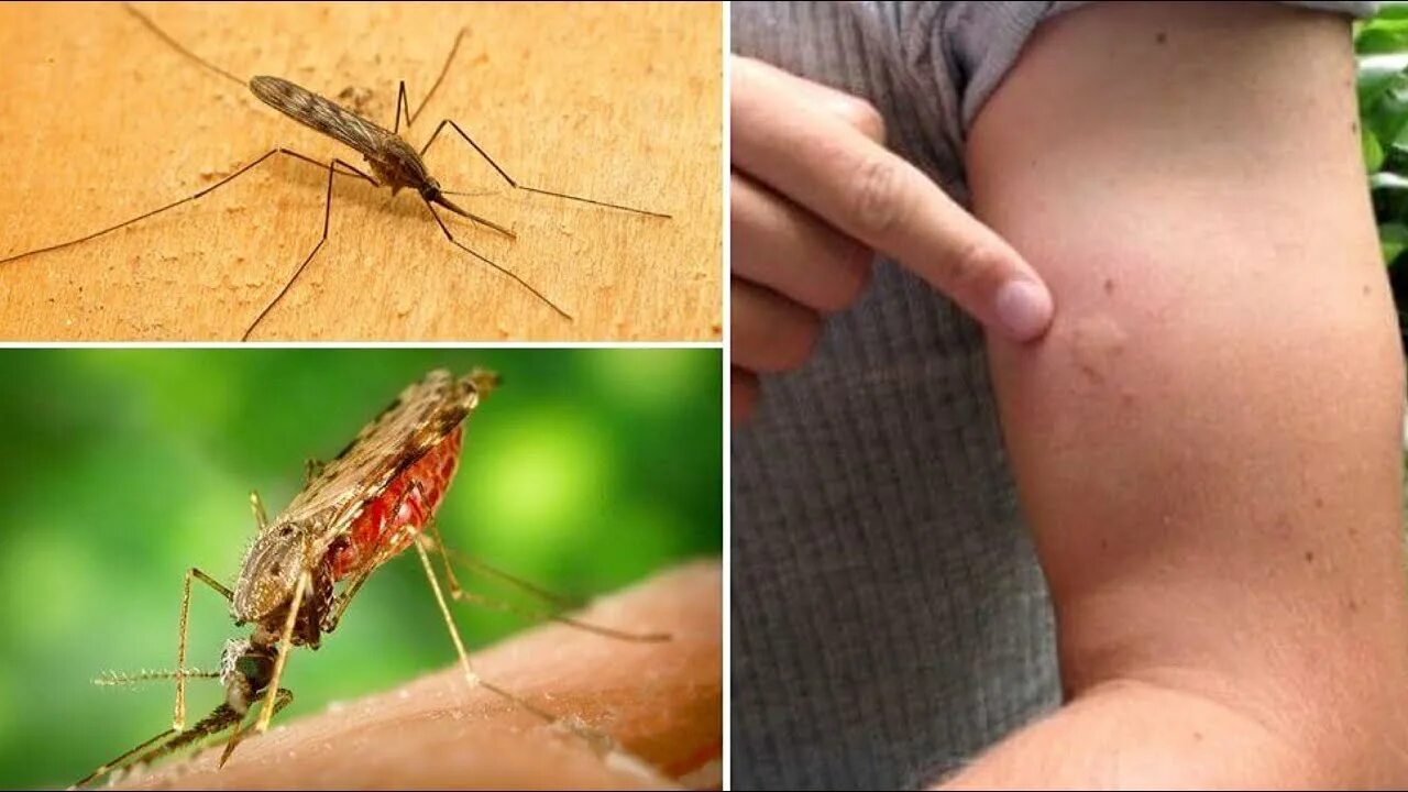 Сильно ли опасно. Малярийный комар и малярия. Укус Малери малярийный комар. Малярийный комар это паразит.