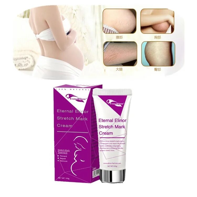 Stretch mark cream. Anti stretch Mark Cream для беременных. Stretch Marks Cream от растяжек. Stretch Marks крем от растяжек Dr.James.