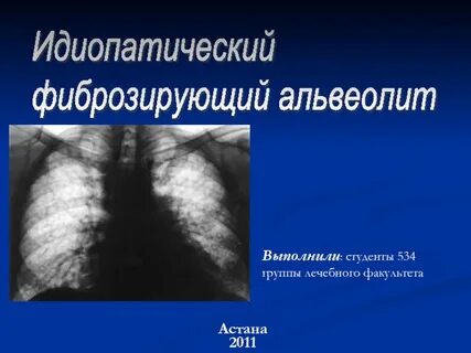 Фиброзирующий альвеолит
