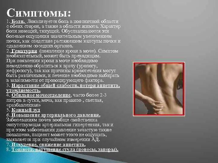 Как определить что болят почки. Болят почки симптомы. болят почки симптомы у женщин. признаки что болят почки.