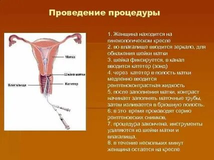 Катетер перед введением необходимо обработать