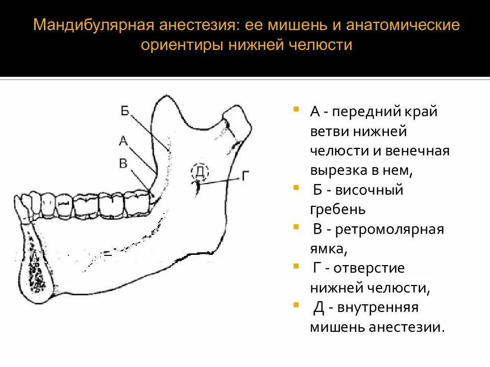 Анестезия по гейтсу. Проводниковая анестезия нижней челюсти мандибулярная. Ретромолярная ямка нижней челюсти. Ретромолярный треугольник нижней челюсти. Ретромолярная область нижней челюсти.