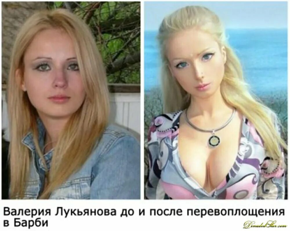 Синди кимберли 2020. Меган фокс ринопластика. Валерия аматуе лукьянова до пластики. Алена омович. Пластика красивых девушек.