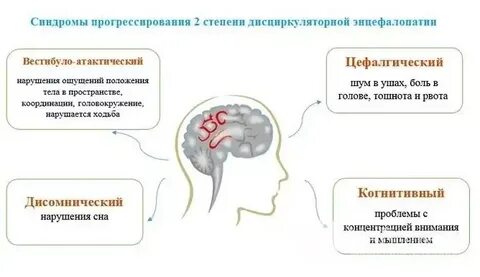 Вестибуло атактический синдром симптомы лечение