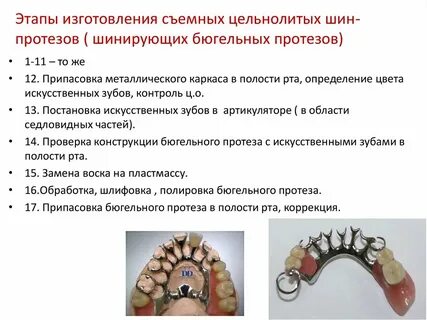 Бюгельный протез коррекция