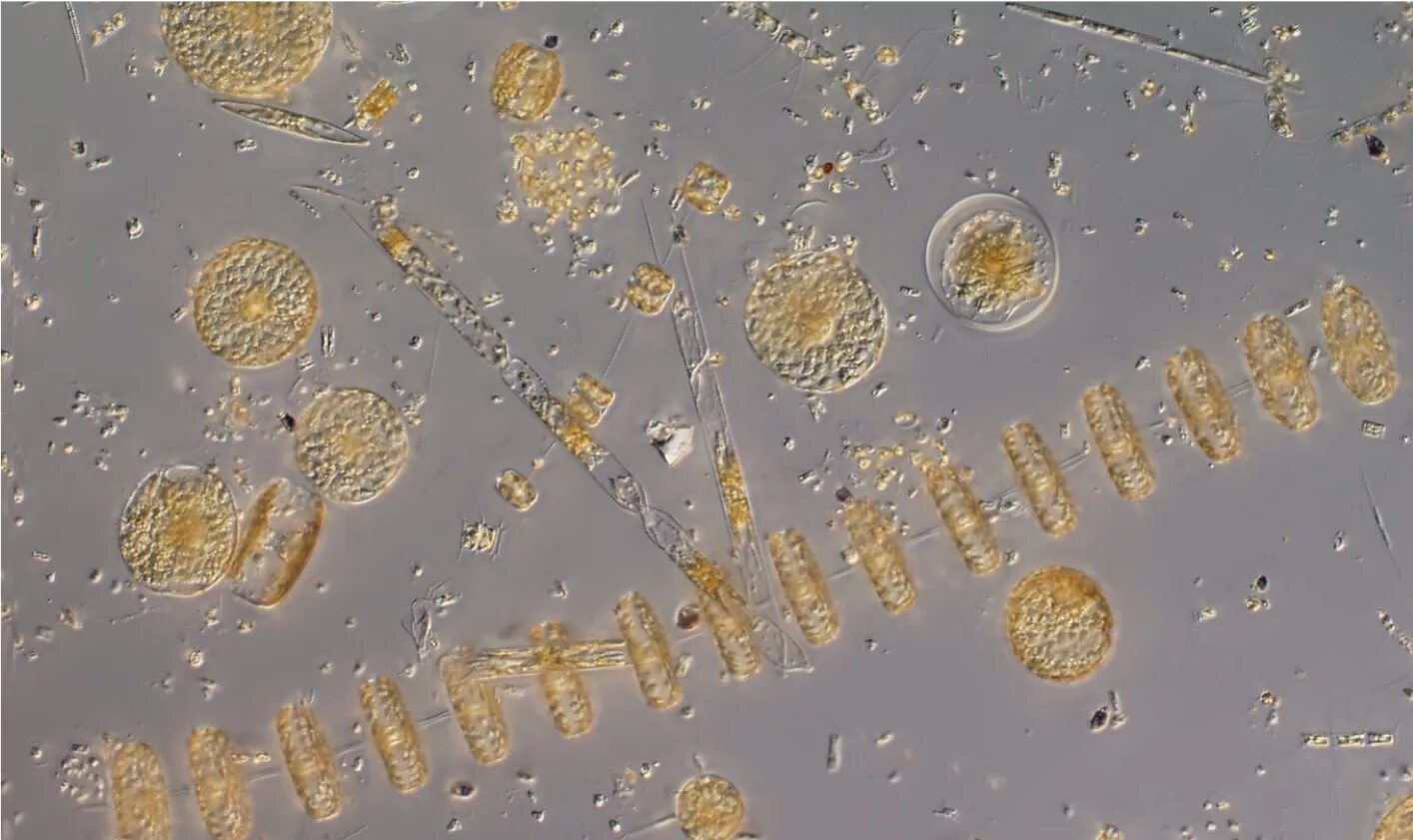 Фитопланктон хищники сапрофиты. Фитопланктон под микроскопом. Фитопланктон в биоиндикации. Фитопланктон строение.