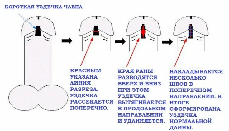Сделать Больно Мужчине Во Время Секса