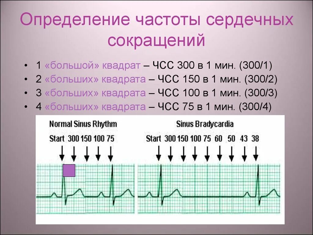 Частота человека как определить