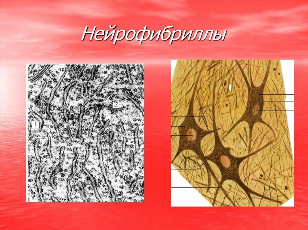 Нейрофибриллы функции. Нейрофибриллы гистология. нейрофибриллы нейрона. нейрофибриллы в нервных клетках препарат. нейрофибриллы под микроскопом.