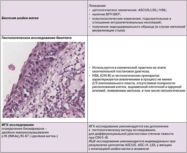 Дисплазия шейки матки гистология. Интраэпителиальная неоплазия шейки матки HSIL. Дисплазия шейки матки конизация. Конизация гистология