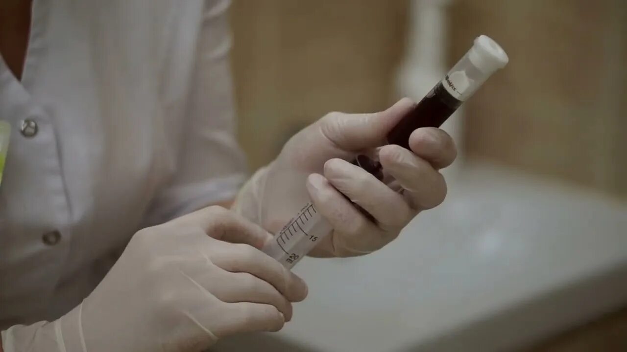 Плазмолифтинг cortexil. Prp терапия cortexil. плазмолифтинг кортексил prp. шприц пробирка cortexil prp. центрифуга cortexil prp.