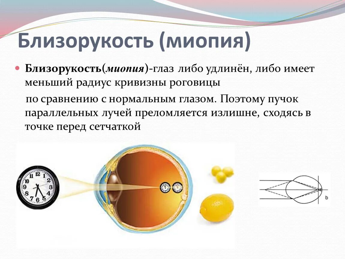 Дефект зрения как сохранить зрение физика 9. Дефект зрения как сохранить зрение физика 9