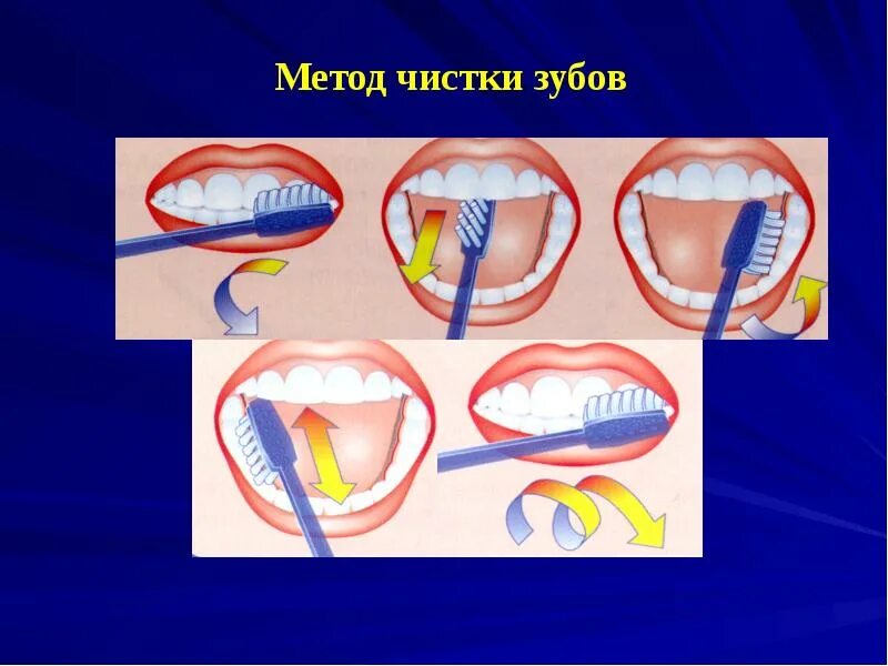 Метод чистки басса. Метод чистки басса