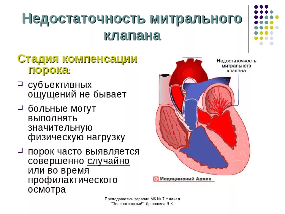 Порок митрального клапана сердца. Недостаточность митрального клапана сердца. Недостаточность митрального клапана структура. Митральный стеноз сердца гемодинамика.