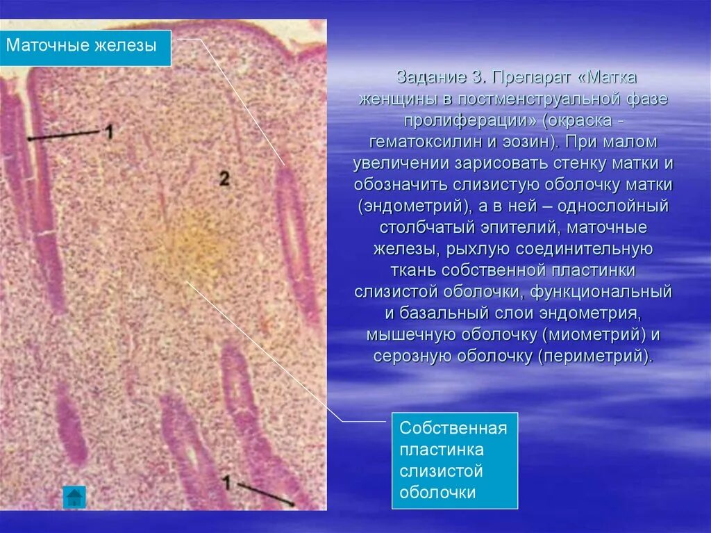 Увеличение больших половых. Слизистая оболочка матки гистология. Фазы эндометрия гистология. Железы матки гистология препарат. Железы эндометрия гистология.