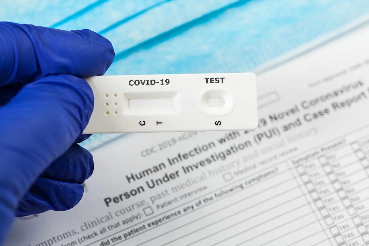 Экспресс-тест на ковид. Тест covid-19 antigen rapid test kit. Положительный тест на коронавирус экспресс тест. Экспресс пцр тест на ковид. Положительный экспресс тест на коронавирус.