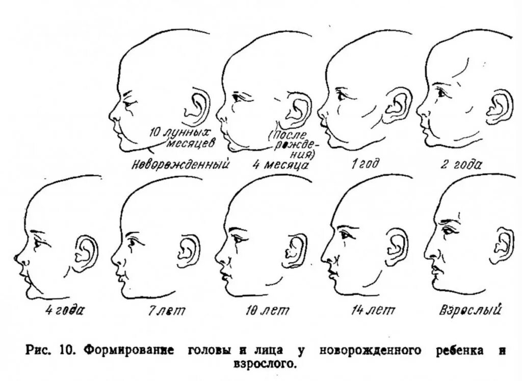 Правильная форма черепа у младенца 2 месяца. Форма головы сбоку младенца. Форма черепа у новорожденного норма. Форма головы у грудничка норма.