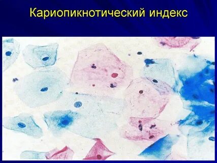 Индексы в гинекологии