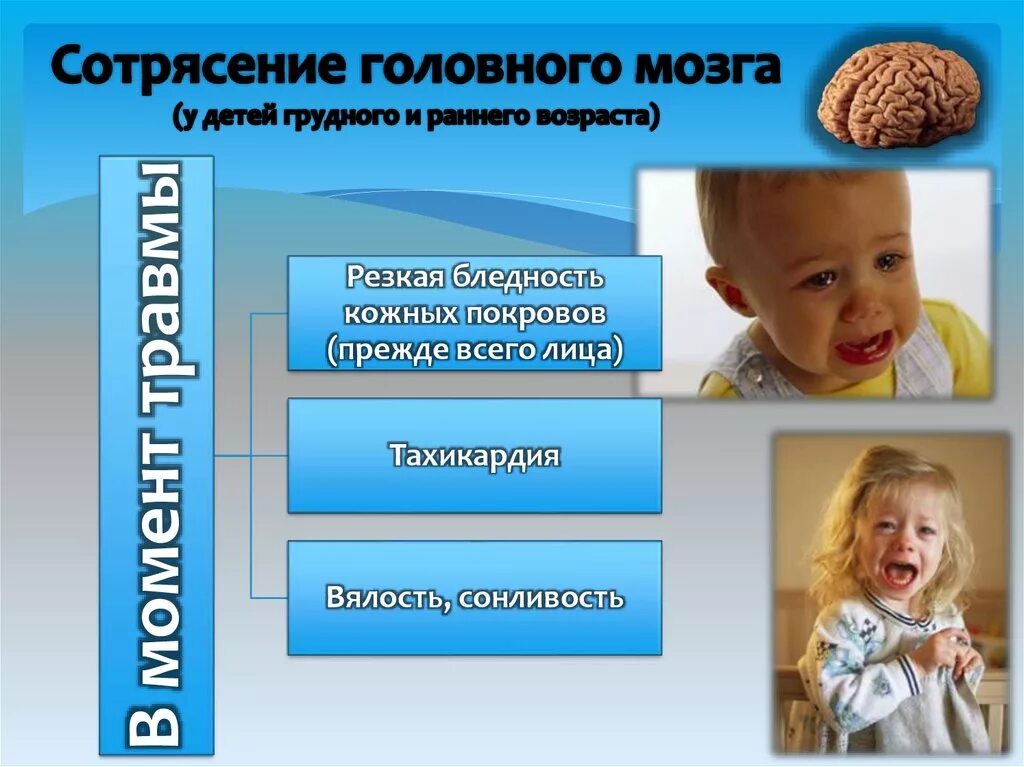 Сотрясение в год. Сотрясение мозга симптомы у детей. Симптомы сотрясения мозга у ребенка 1. Сотрясение у ребенка симптомы. Сотрясение у малыша симптомы.