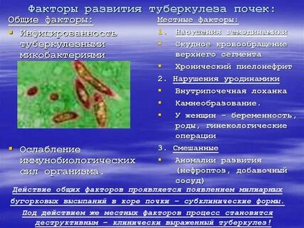Туберкулез возникновение