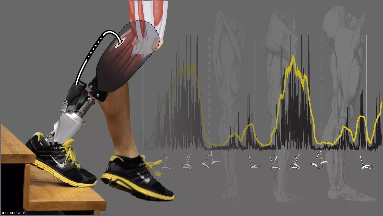Первая бионическая рука 1993. Бионические протезы роботизированные. Протез 3f80. Создание протезов. Touch bionics протезы.