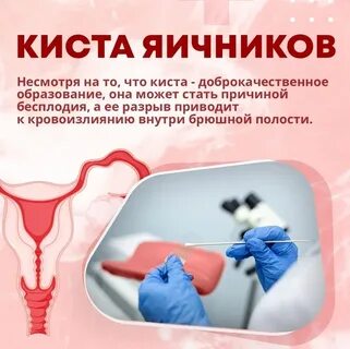 Снять воспаление кисты