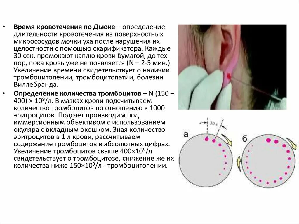 Тест определите кровотечение. Длительность кровотечения по Дуке. Длительность кровотечения по Дуке норма. Методы определения времени свертывания и кровотечения. Длительность кровотечения по Дьюку норма у детей.