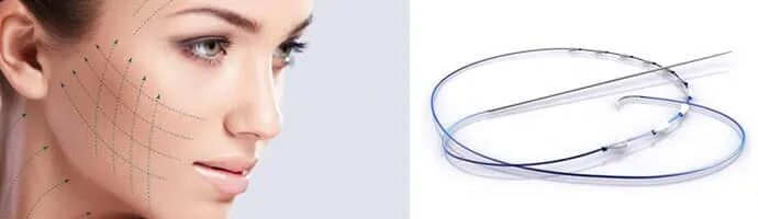 Aptos scan. Нитевой лифтинг нитями aptos (light life, visage, body, needle 2g, tread 2g). нити аптос lift thread soft 2 g. нитевой лифтинг аптос нано.