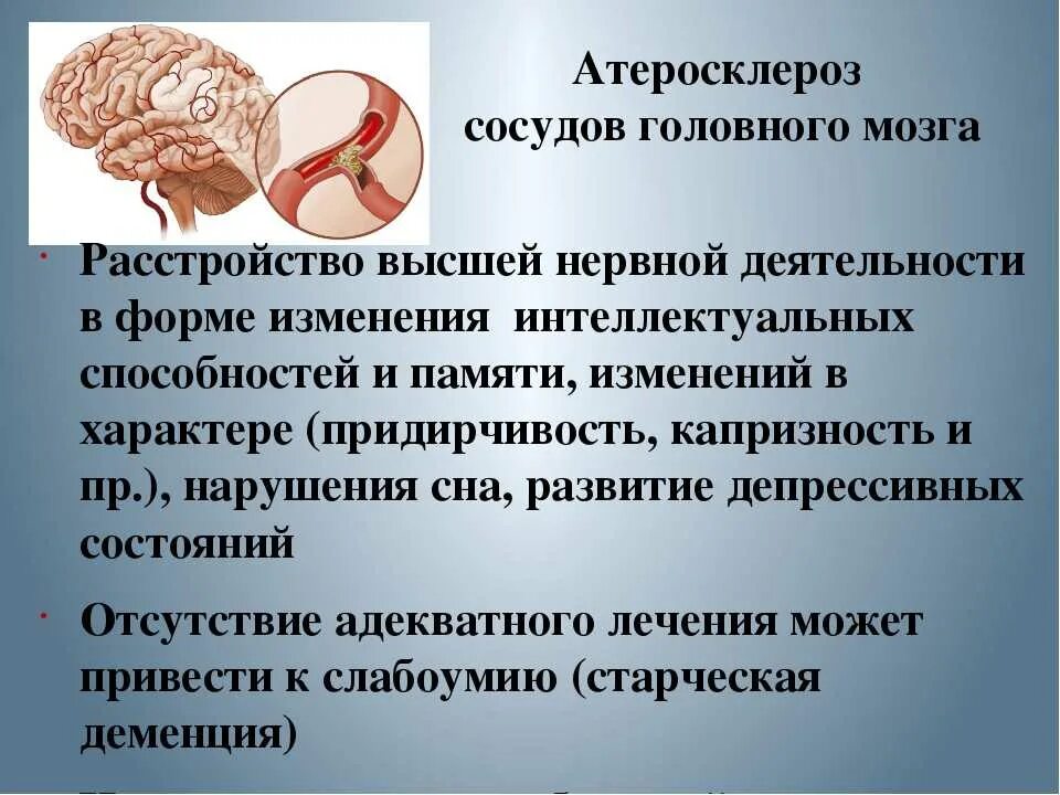 Симптомы атеросклероза головного мозга у женщин. Признак атеросклероза артерий головного мозга. клинические проявления атеросклероза артерий головного мозга. атросклероссосудовголовногомозга. атеросклероз сосудов головноготмозга.