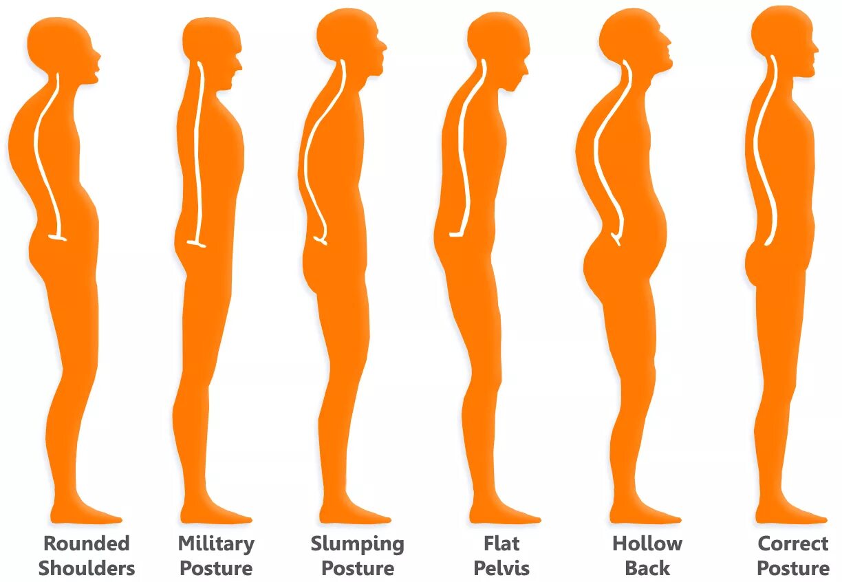 Round shouldered