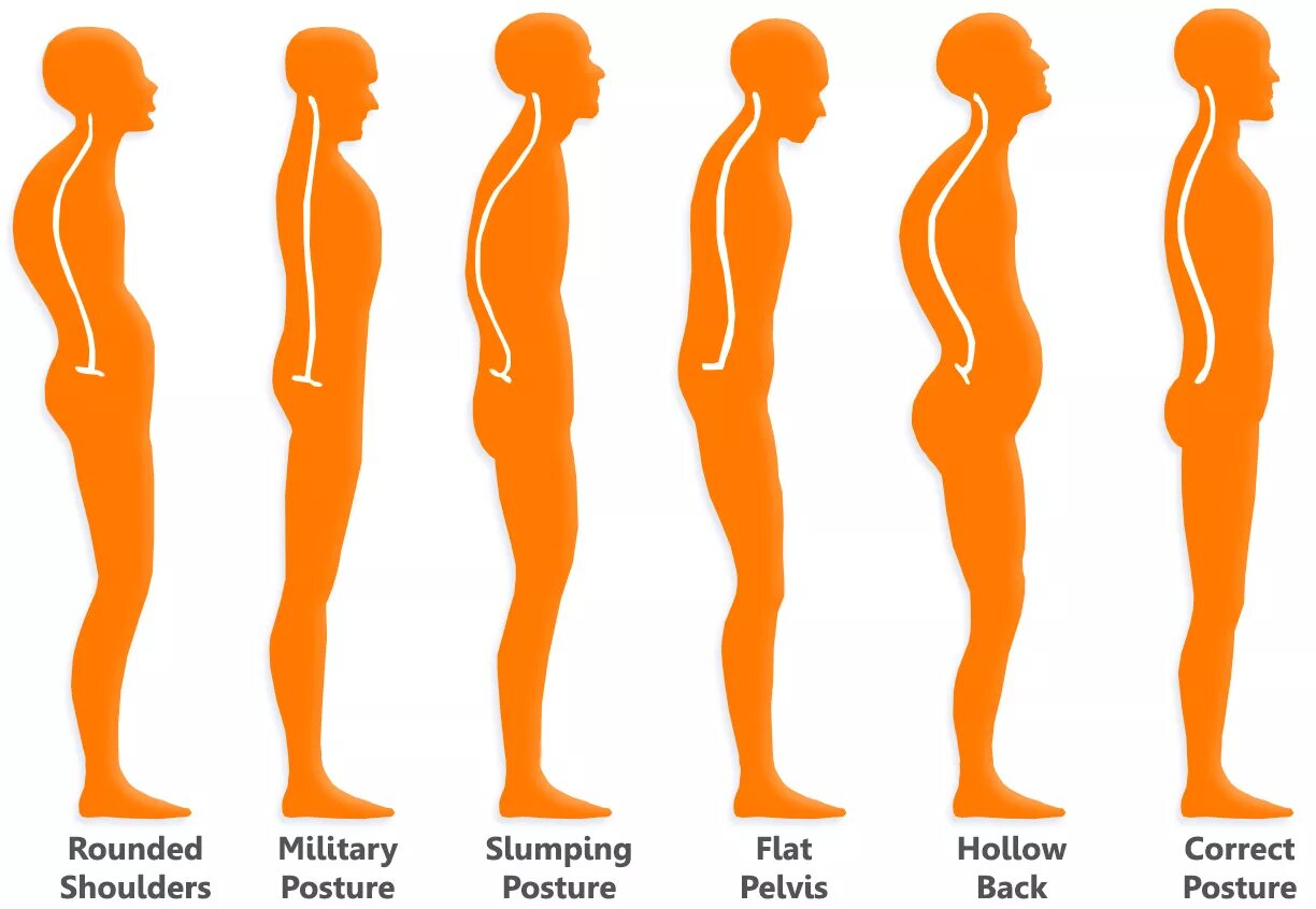 Прямая поясница. Осанка. Осанка человека с боку. Сутулость человека. Здоровая осанка.