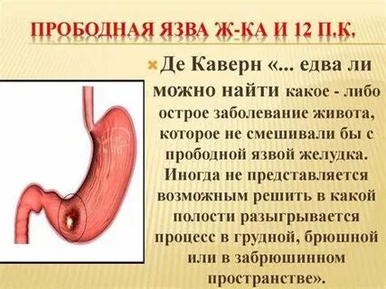 Прободная язва желудка и двенадцатиперстной кишки