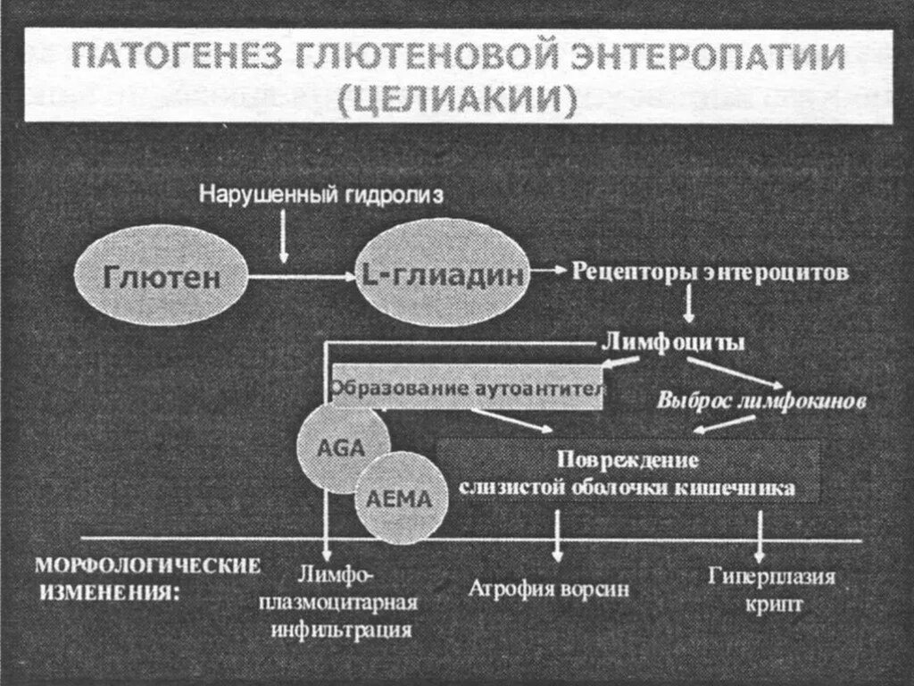 Целиакия диагностика у взрослых. Глютеновая болезнь патогенез. целиакия патогенез иммунология. целиакия у детей патогенез. целиакия у детей этиология патогенез.