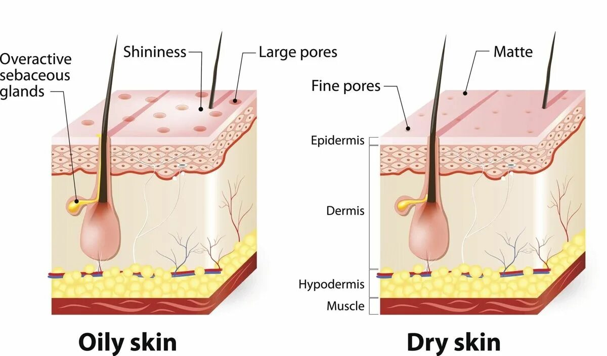 Some type of skin. Oily dry skin. 5 типов кожи дерматология. нормаль человеческая кожа.