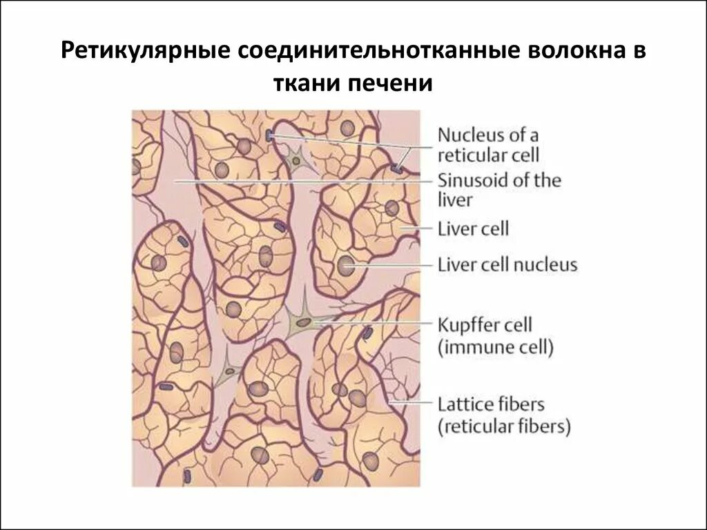 Алкогольный гепатит гистология. Долька печени портальный тракт. Соединительная ткань печени. Цирроз печени гистологический препарат. Цирроз печени гистология.
