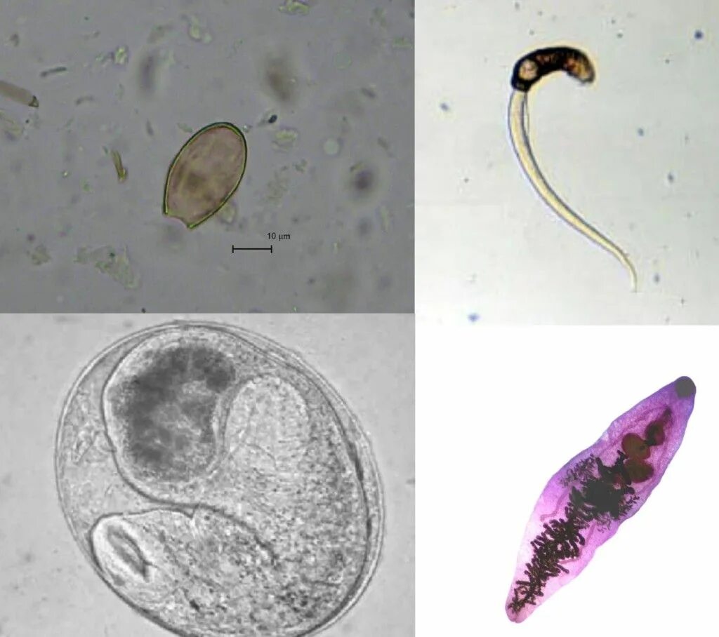 Кошачий (сибирский) сосальщик (opisthorchis felineus). Описторхоз кошачья двуустка. Кошачья двуустка и печеночный сосальщик. Ланцетовидный сосальщик. Кошачья двуустка аскарида.