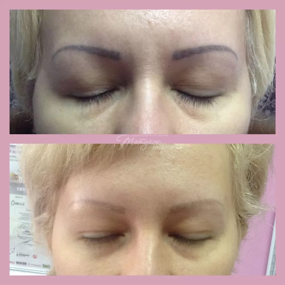 Revivink ревайвинк для удаления татуажа. удаление зеленых бровей ремувер. ревайвинг для удаления татуажа бровей. плакат для мастера удаления татуажа. ревайвинг.