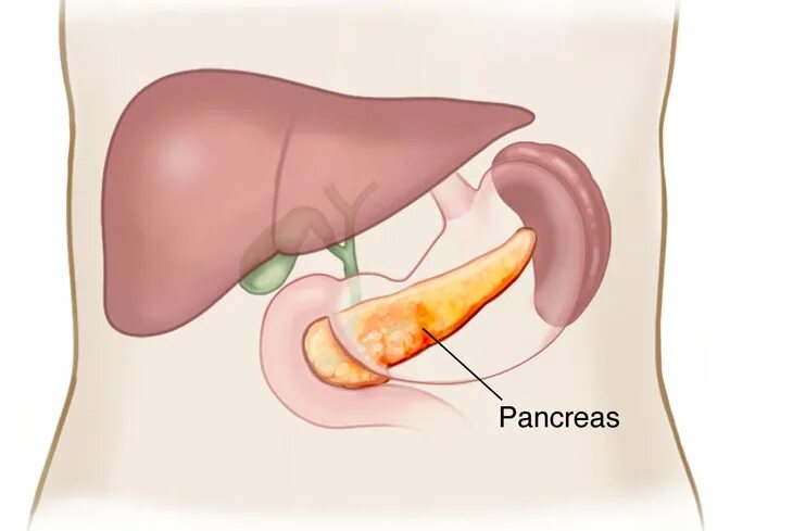 Поджелудочная железа отечность