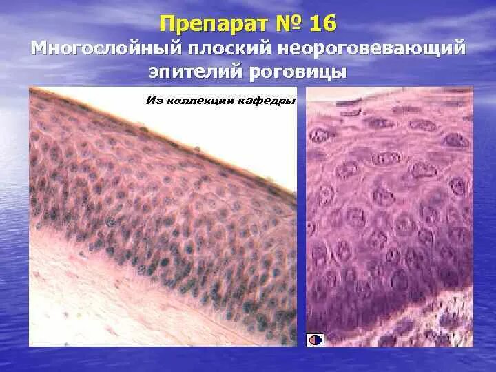Сухая ороговевающая кожа