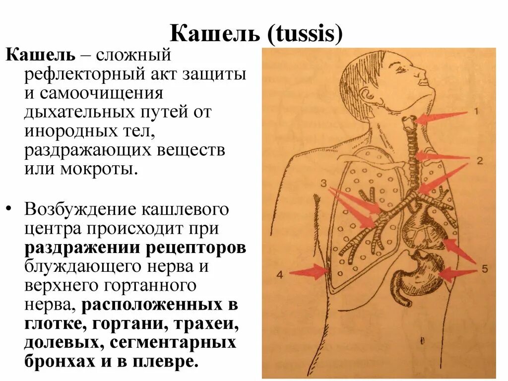 Дыхание при сильном кашле. При раздражении дыхательных путей. Кашель, при раздражении дыхательных путей инородным телом.