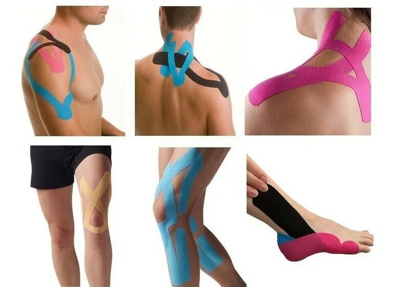 Кинезио-тейп лента. Кинезио-тейп лента. Кинезио тейп лента кинезиологическая. Кинезио тейп kinesio. Кинезио тейп лента кинезиологическая.