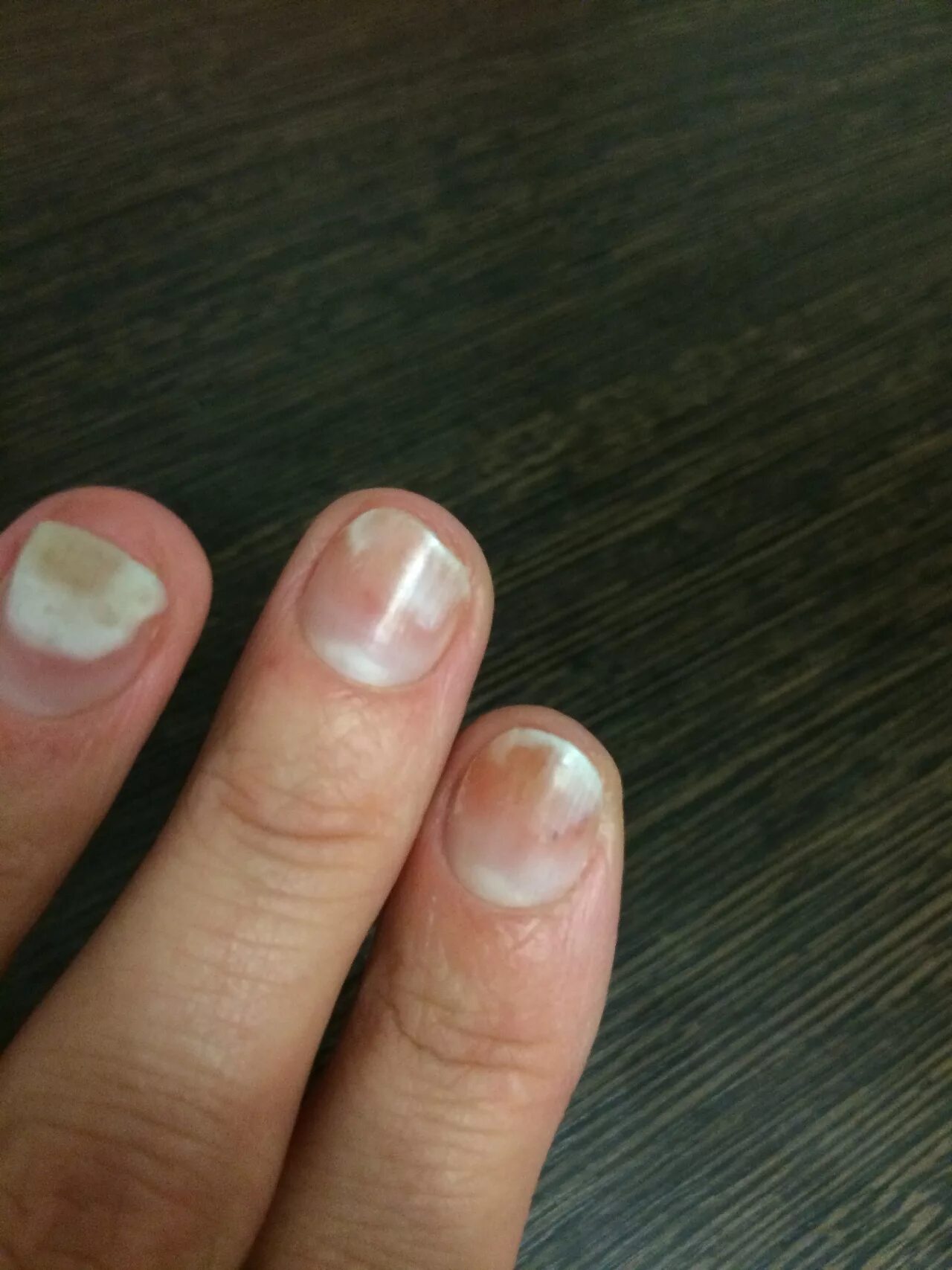 Отзыв о Жидкость для снятия лака Dr. Nail без ацетона с алоэ такой ужасной жидко