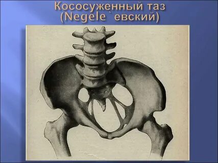 Таз стелет