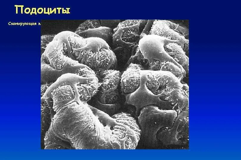 Подоциты почки гистология. Подоциты нефрона. Клетки подоциты. Подоциты. Строение нефрона подоциты.