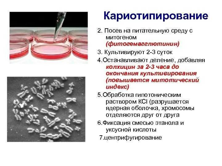 Кариотипирование в какую фазу. Кариотипирование. кариотипирование метод. методы кариотипирования. посев на питательные среды.