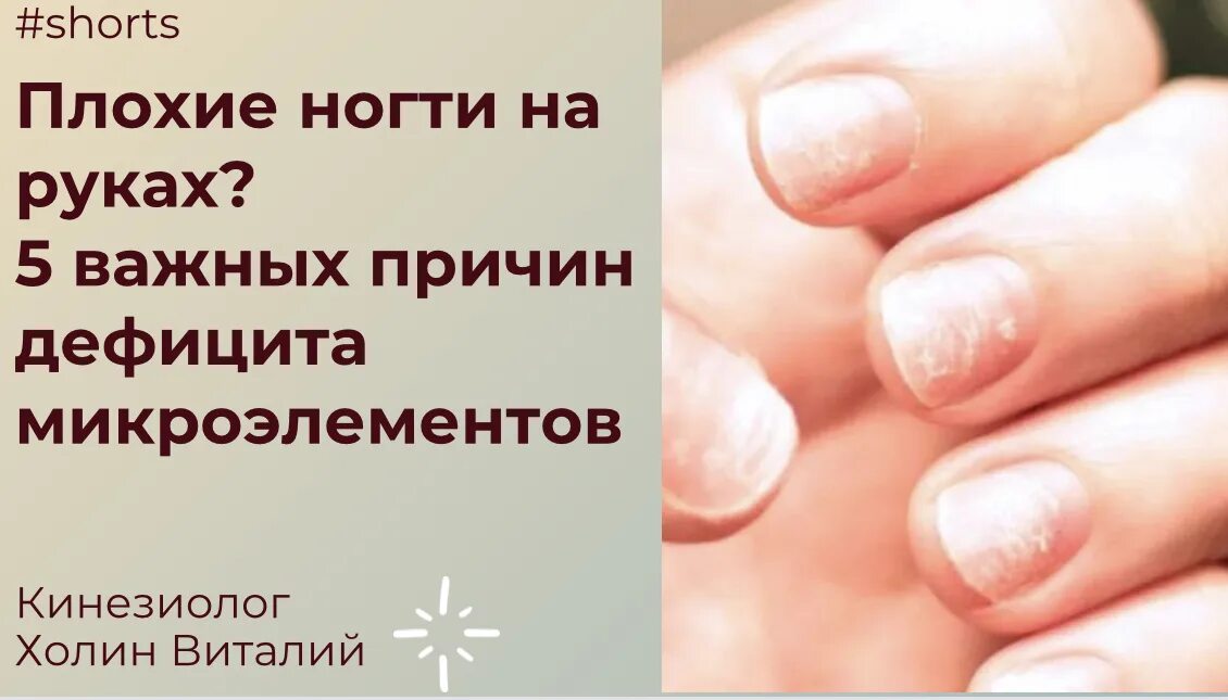Почему ногти плохо держатся